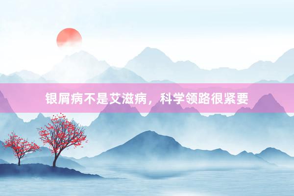 银屑病不是艾滋病，科学领路很紧要